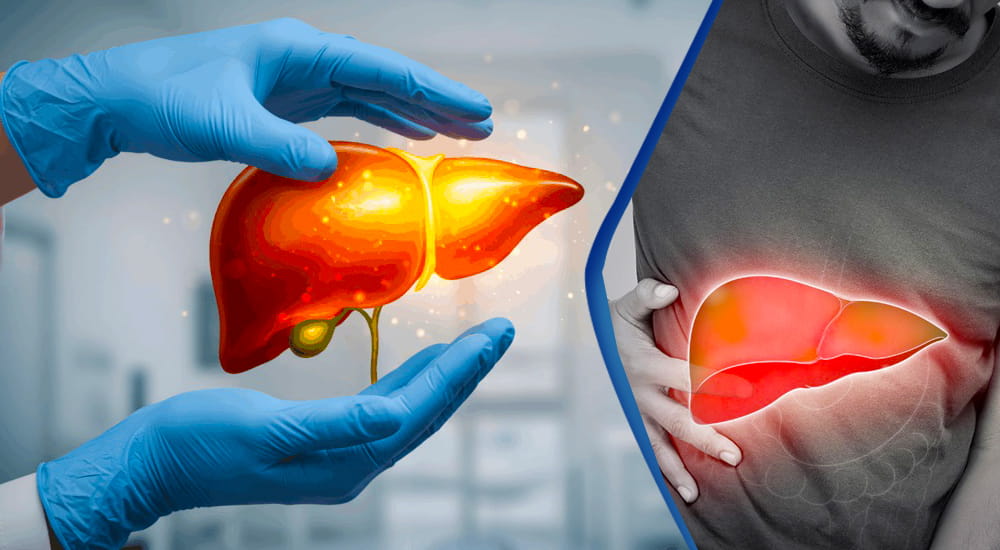 Grade 1 Fatty Liver : Symptoms and Causes