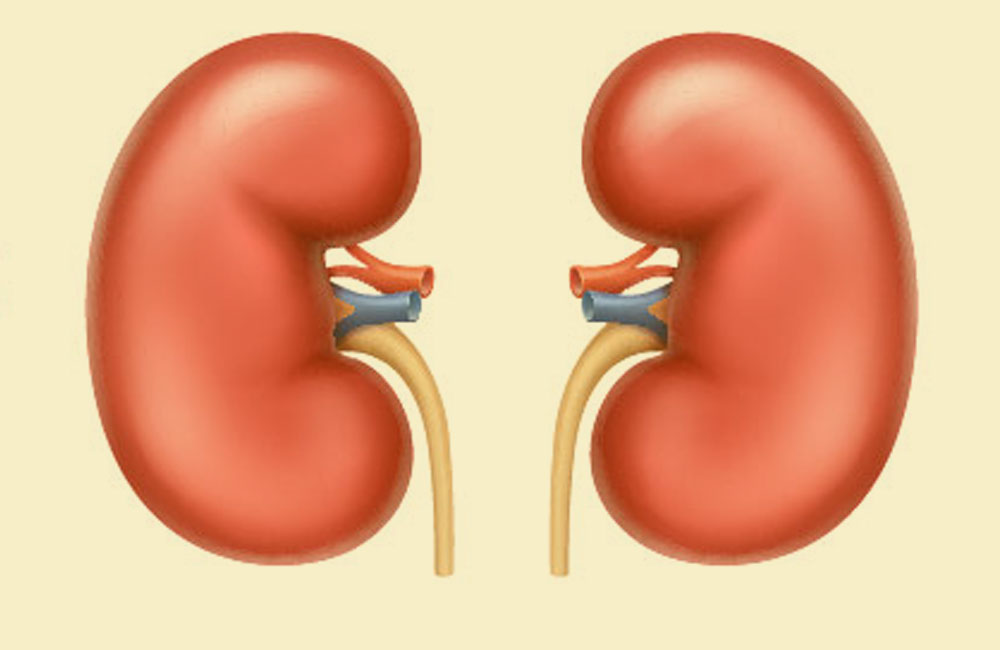 Causes of kidney failure you should know about