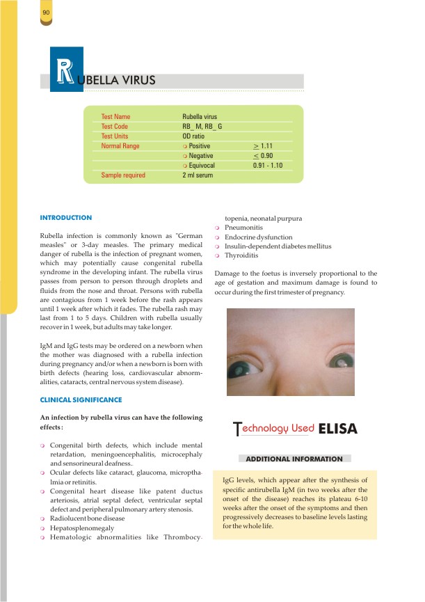 Rubella - IgM Test
