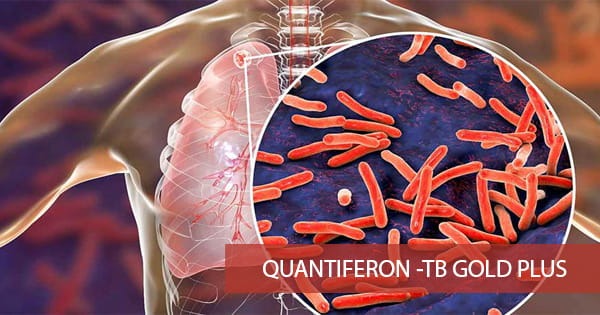 QUANTIFERON -TB Gold Plus